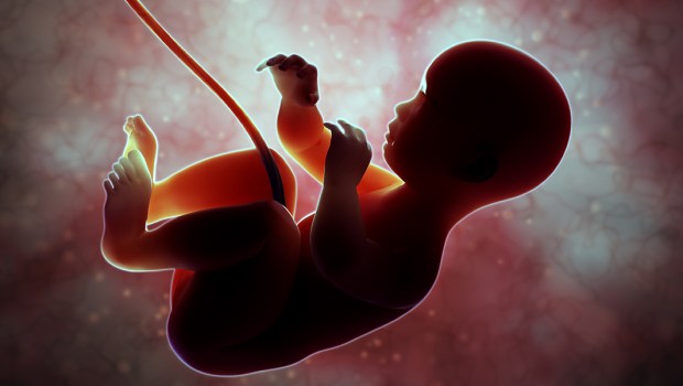 ABORCJA